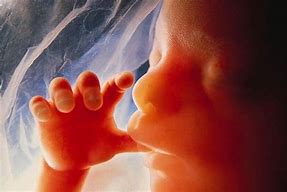Image result for fetal