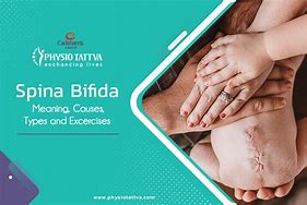 Image result for Spina Bifida Signs and Symptoms