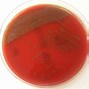 Image result for Gram-positive Bacilli Chart