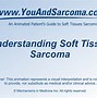 Image result for Sarcoma Staging Head and Neck