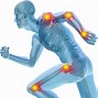 Image result for Pain Relief Animation