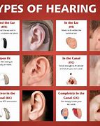 Image result for Comparison of Hearing Aids Types