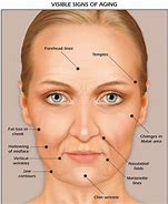 Image result for Face in Cheeks