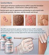 Image result for Genital Warts for Men