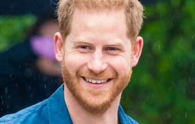 Image result for Prince Harry Hairline