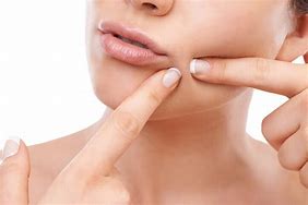 Image result for New Pimple Popping