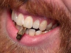 Image result for Cricket Teeth Person