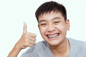 Image result for Kid with Braces Meme
