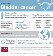 Image result for Bladder Cancer Prognosis