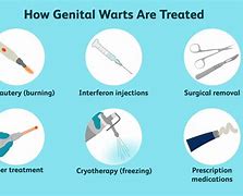 Image result for Genital Wart Stalk