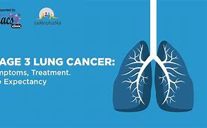 Image result for Stage 3 Lung Cancer