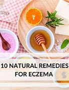 Image result for Treatment for Eczema On Face
