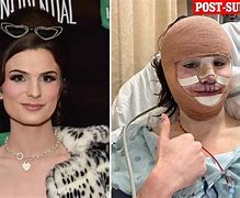 Image result for Dylan Mulvaney Before and After