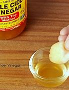 Image result for Genital Wart Treatment Cure