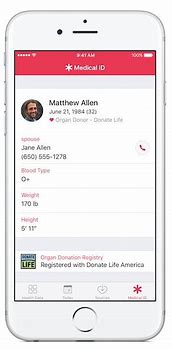 Image result for Organ Al iPhone 2017