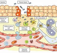 Image result for Inflammation Process