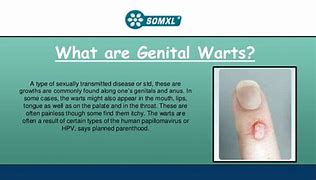 Image result for Genital Warts Removal Disease