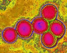 Image result for Spanish Flu Microscope