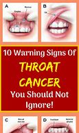 Image result for STD Throat Cancer