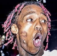 Image result for Famous Dex Missing Teeth