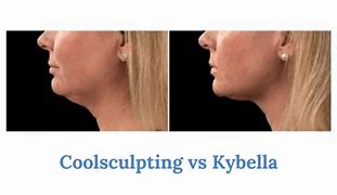 Image result for Kybella vs CoolSculpting Chin