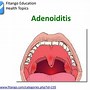 Image result for adenoidek