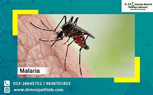 Image result for Malaria