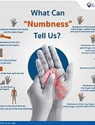 Image result for Numbness in Children