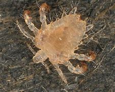 Image result for Crabs STD vs Lice