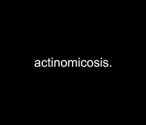 Image result for actinomidosis
