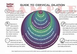 Image result for Balloon Cervical Dilation