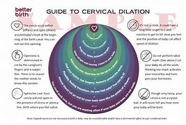 Image result for Baby Dilation Chart