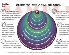 Image result for 4 Cm Dilated Cervix