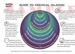 Image result for 4 Cm Dilated