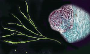 Image result for Sporangium Botany