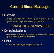 Image result for What Is the Carotid Sinus
