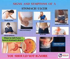 Image result for Intestine Ulcer