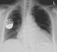 Image result for Symbol for X-ray