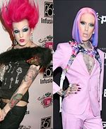 Image result for Jeffree Star Before