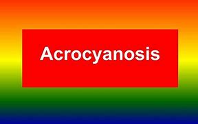 Image result for acracis