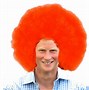 Image result for Prince Harry Losing Hair