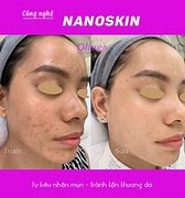 Image result for Nano Skin Care