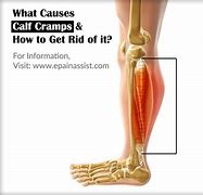 Image result for Sudden Pain in Calf Muscle
