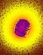 Image result for Moluskum Kontangiosum Virus