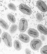 Image result for Molluscum Contagiosum Causative Virus