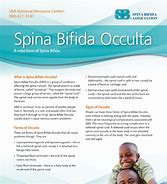 Image result for Spina Bifida Occulta
