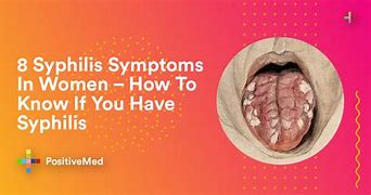Image result for Woman with Syphilis