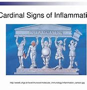 Image result for 5 Signs of Inflammation