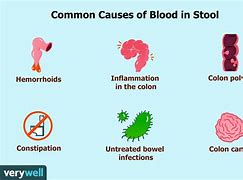 Image result for Blood On Stool Surface