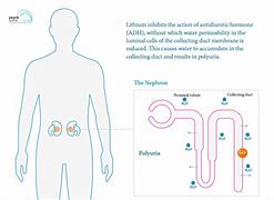 Image result for Lithium Renal